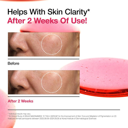 Anua Niacinamide 10 Txa 4 Serum, Brightening Korean Serum For Dark Spots & Hyperpigmentation