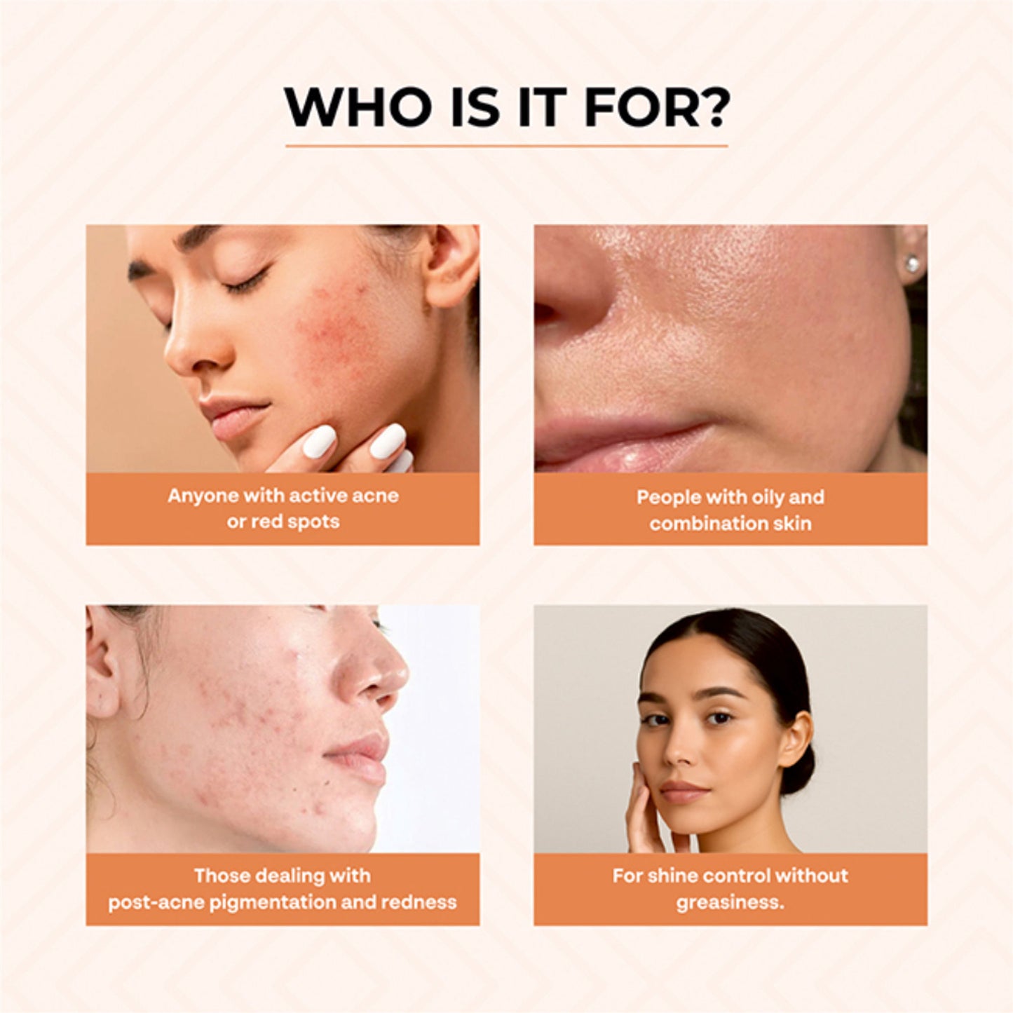 Dr. Sakhiya Acne & Pimple Morning Cream