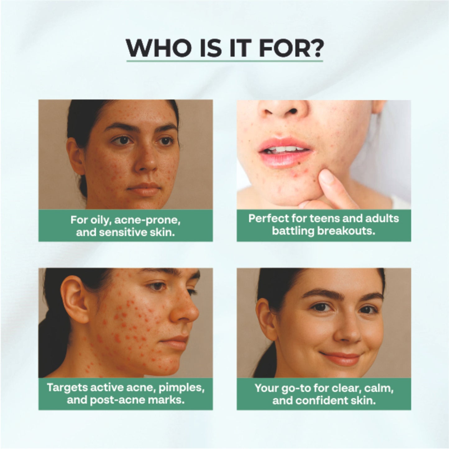 Dr. Sakhiya Acne & Pimple Moisturizer