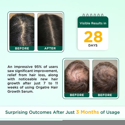 Orgatre Hair Oil With 28 Herbal Oils – Promotes Hair Growth, Reduces Hair Fall & Dandruff
