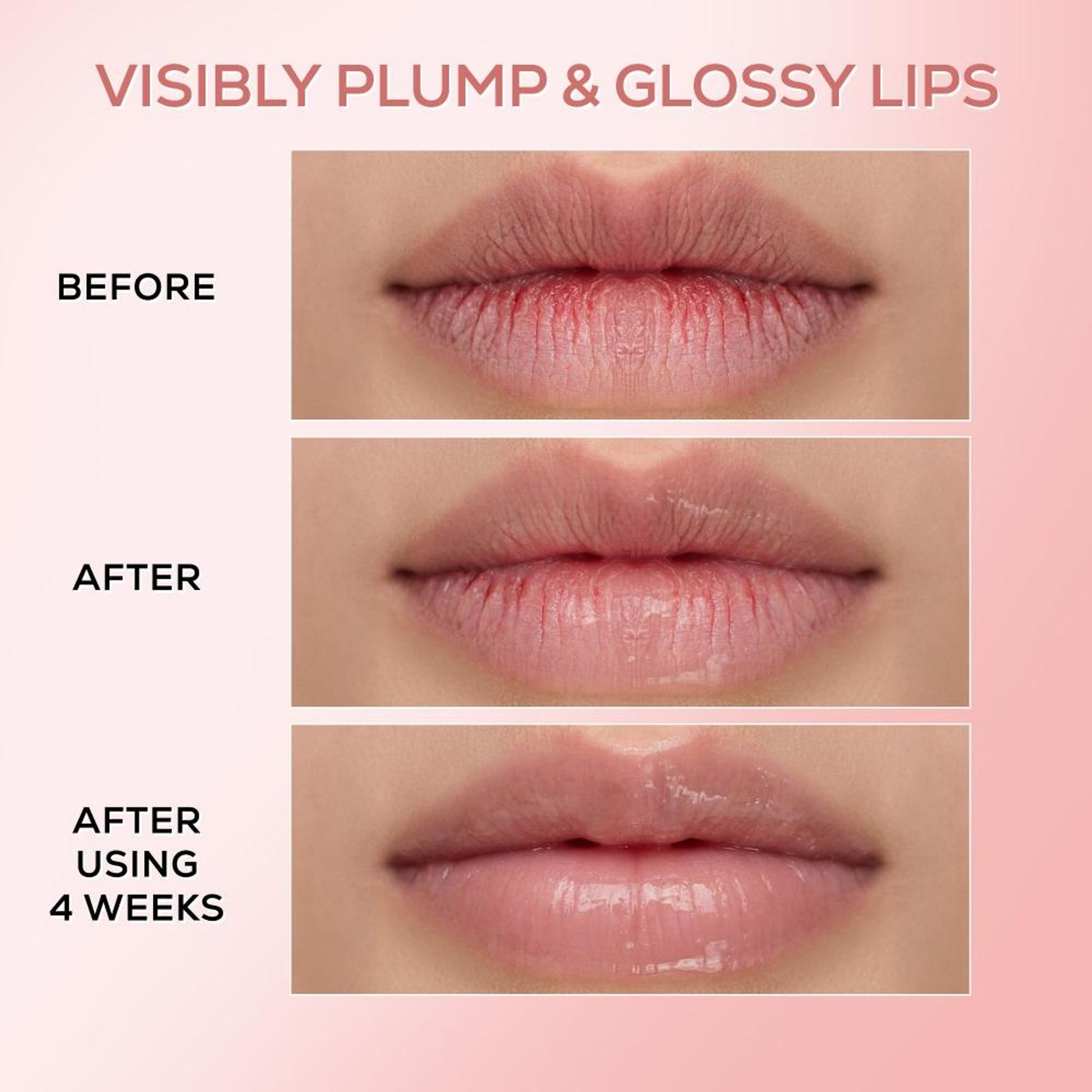 Renee Cosmetics Pink Therapy PDRN Moisturizing Lip Balm
