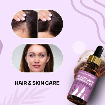 Mountainor 100% Pure Rosemary Essential Oil For Hair Growth, Organic & Natural Oil For Hair & Skin.