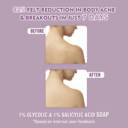 Glamveda 1% Glycolic Acid & 1% Salicylic Acid Body Acne Soap