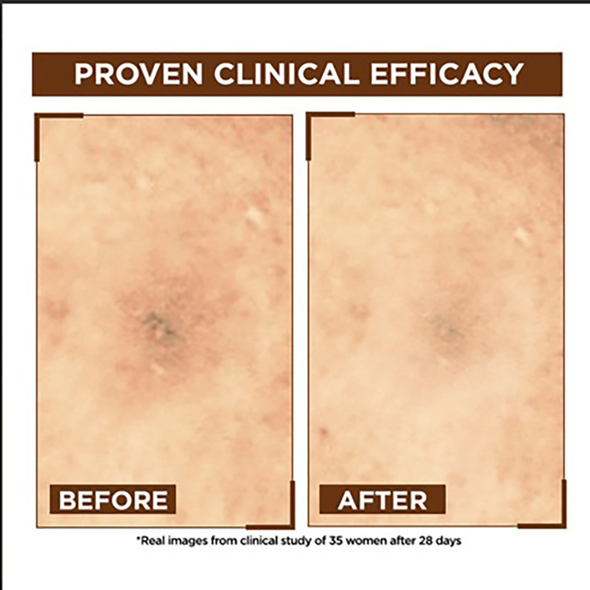 Garnier Bright Complete Vitamin C+ Serum with 10% Pure Vitamin C to Repair & Brighten Skin