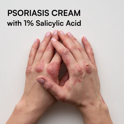 Brinton Psoramist Moisturizing Cream