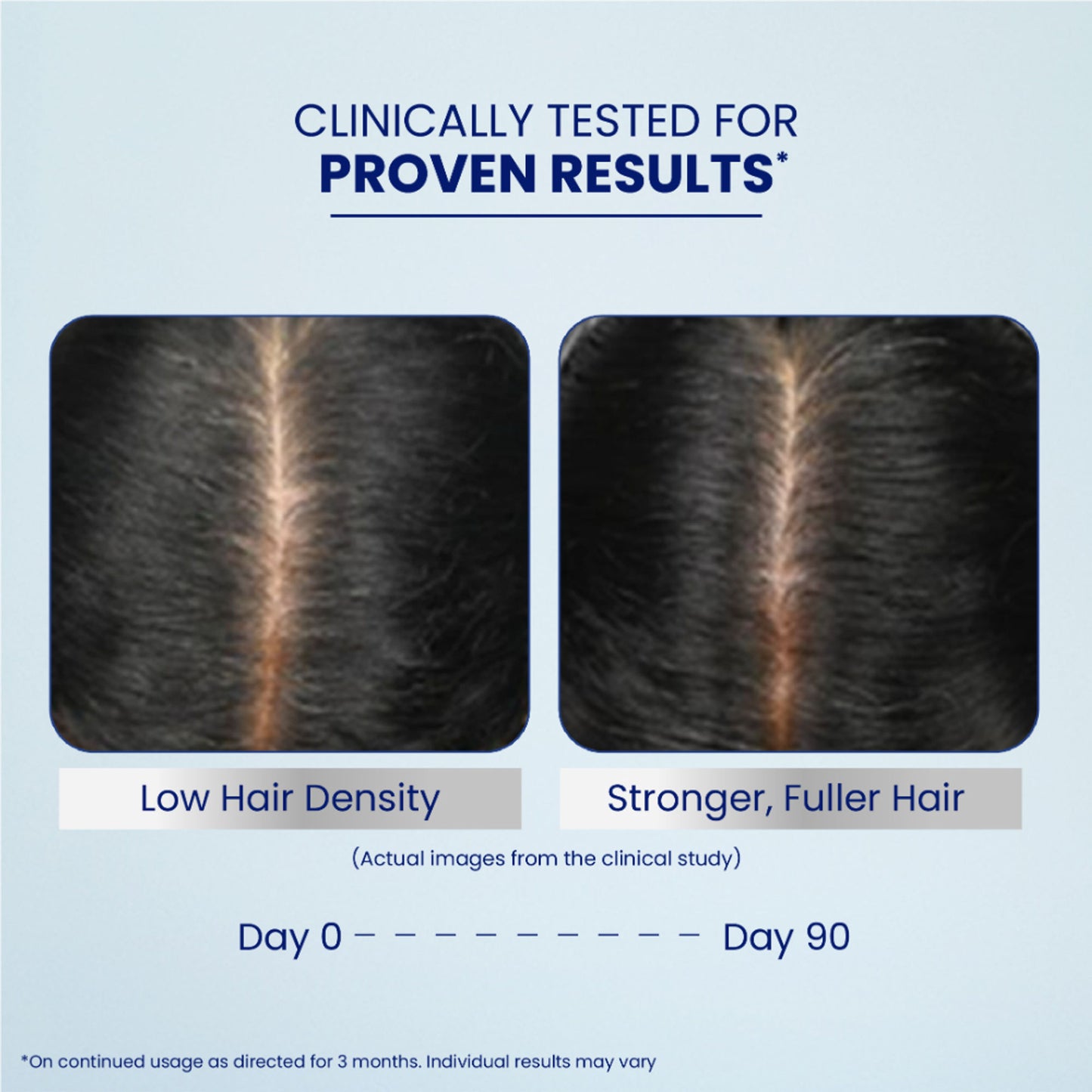 Parachute Advansed Pro Hair Growth Serum