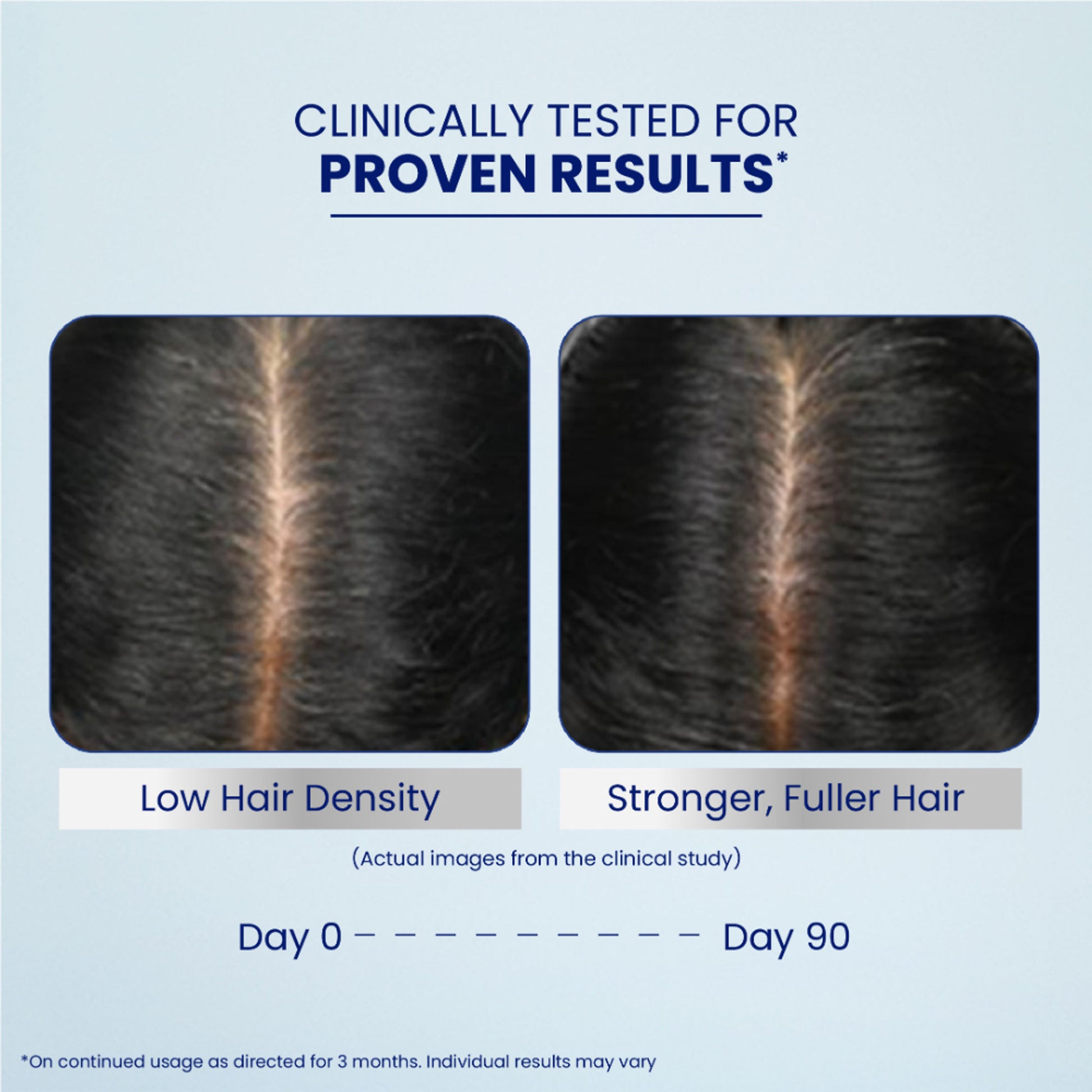 Parachute Advansed Pro Hair Growth Serum