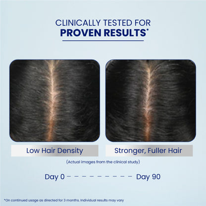 Parachute Advansed Pro Hair Growth Serum