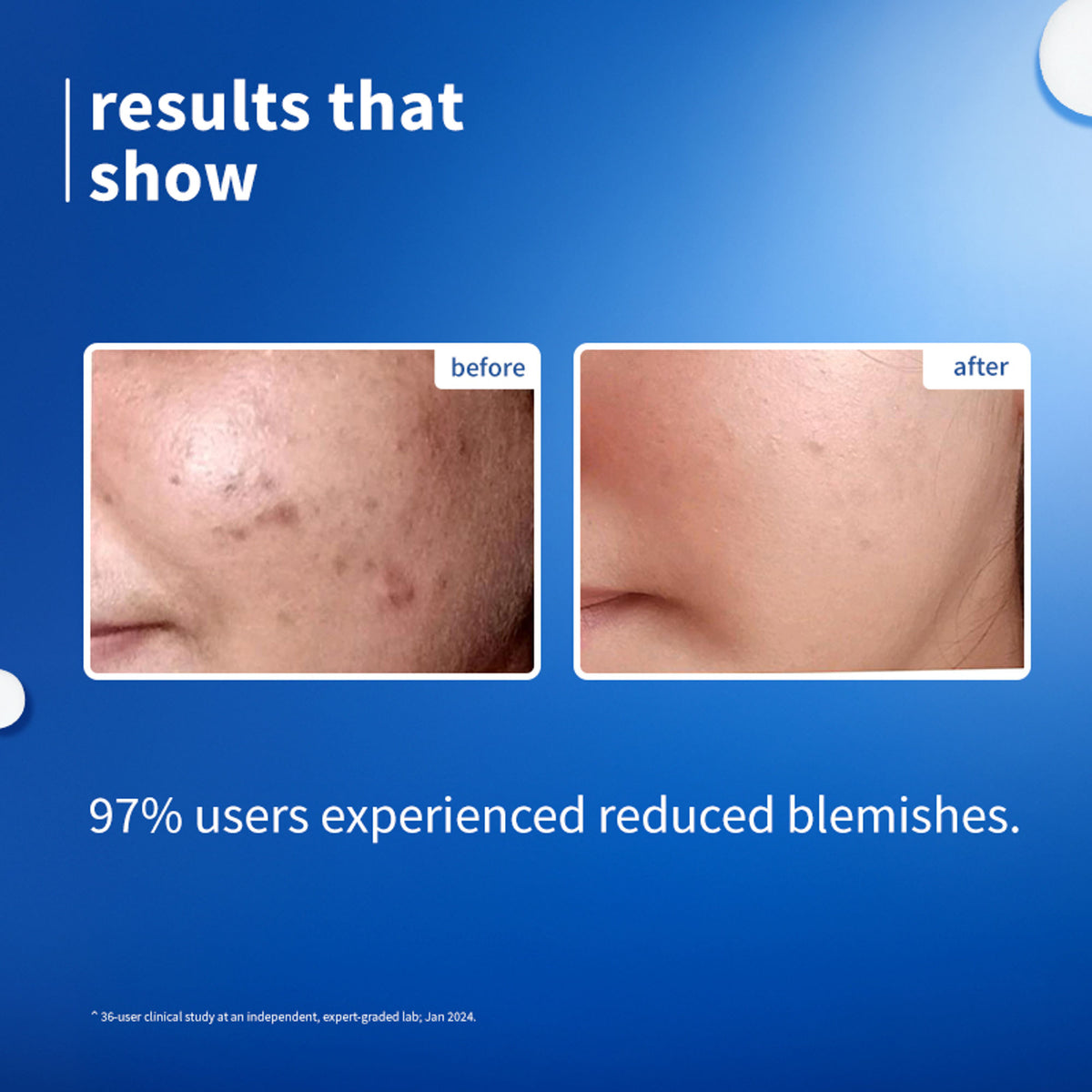 Plum 10% Niacinamide Brightening Face Serum with Rice Water & Ferment - Fades Blemishes & Acne Marks