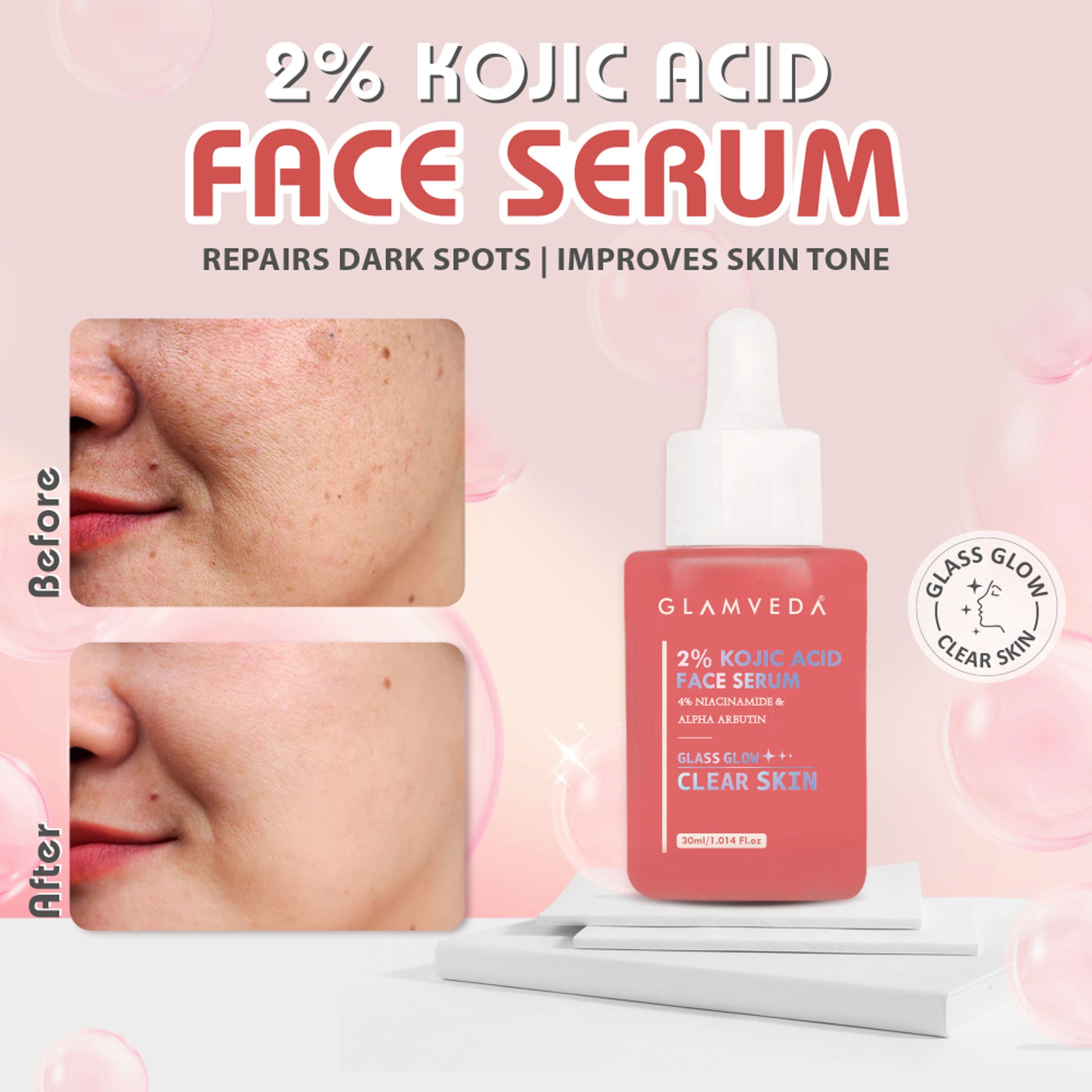 Glamveda 2% Kojic Acid Face Serum