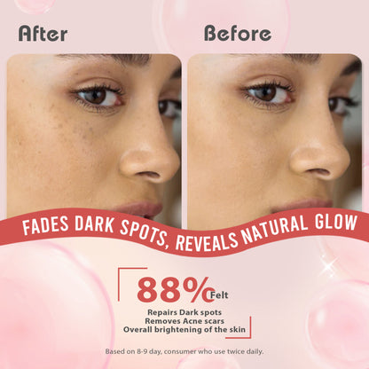 Glamveda 2% Kojic Acid Face Serum