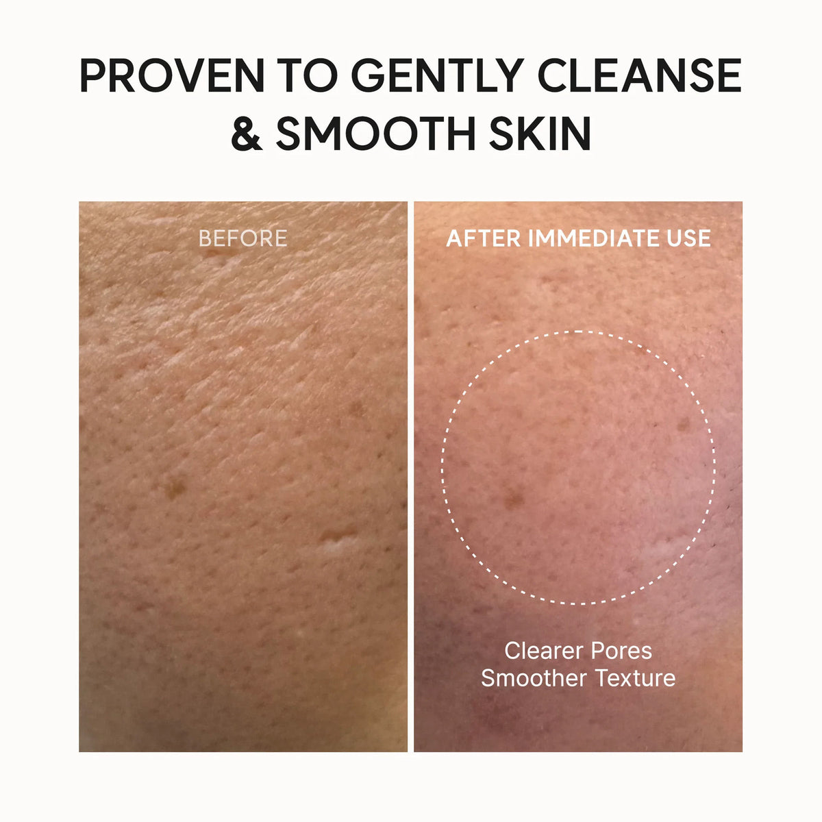 Arencia Fresh Rosehip Rice Mochi Cleanser - All-In-One Cleanser, Mask & Makeup Remover for Dull Skin