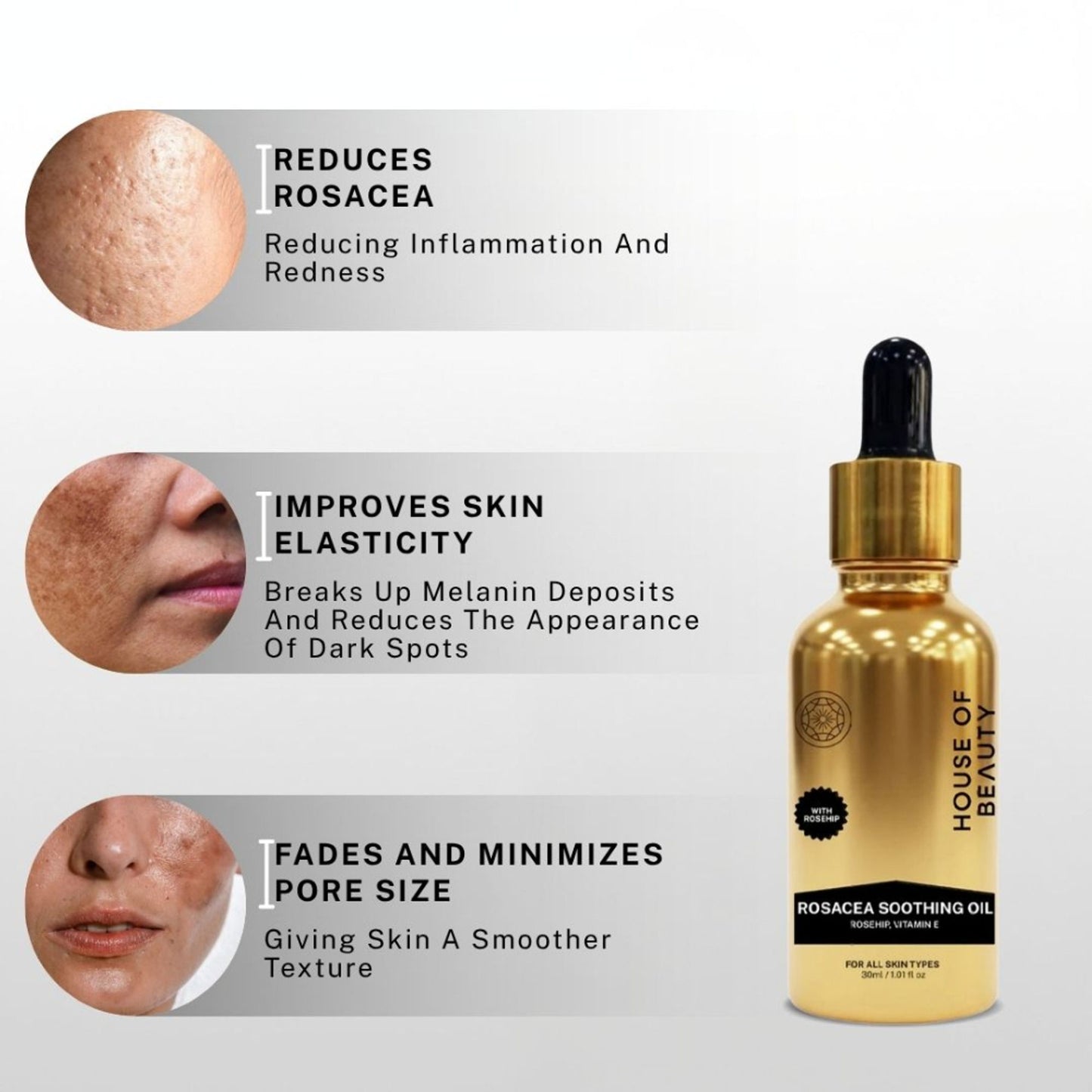 House of Beauty Rosacea Oil (Rosehip + Vitamin E)
