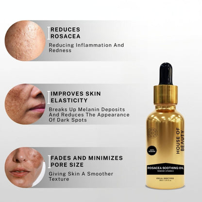 House of Beauty Rosacea Oil (Rosehip + Vitamin E)