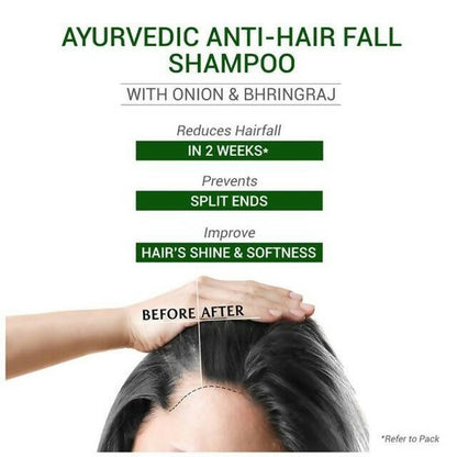 Sesa Ayurvedic Anti-Hair Fall Onion Shampoo - Indyancart
