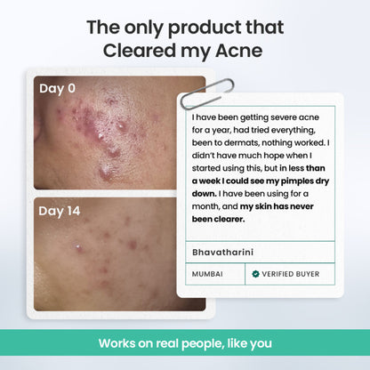 The Solved Skin Rapid Clear Face Wash