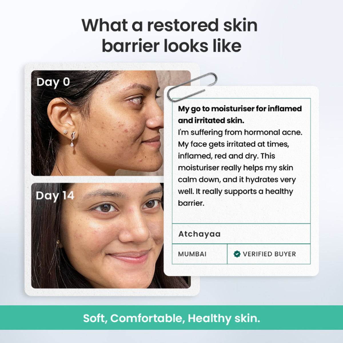 The Solved Skin Barrier Repair Gel Moisturiser
