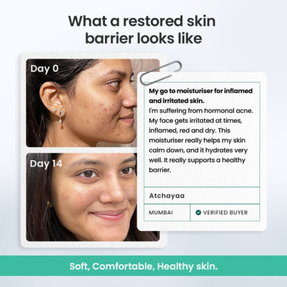 The Solved Skin Barrier Repair Gel Moisturiser