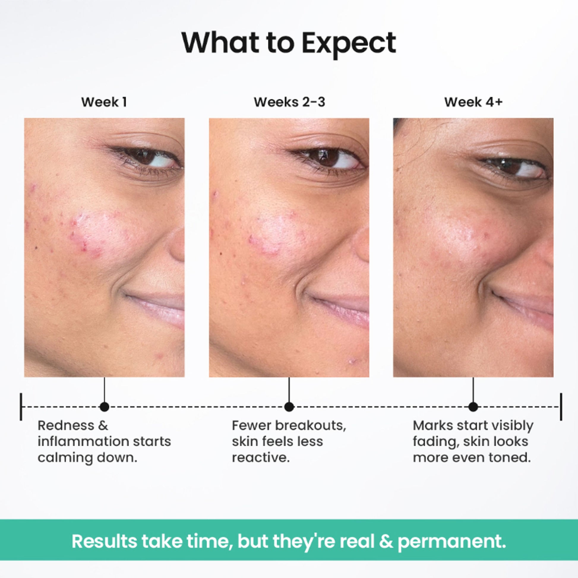 The Solved Skin Spot Fade Advance Repair Serum