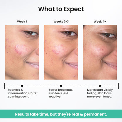 The Solved Skin Spot Fade Advance Repair Serum