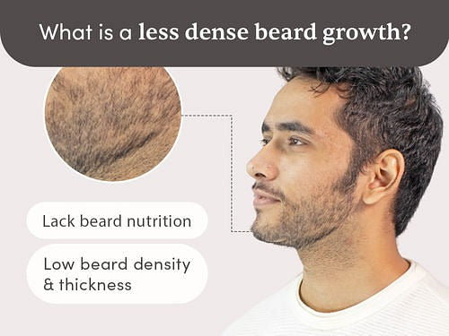 Man Matters Beardmax Growth Serum - Indyancart