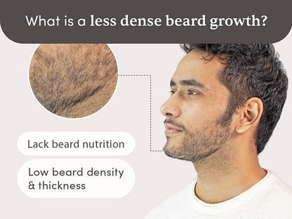 Man Matters Beardmax Growth Serum - Indyancart