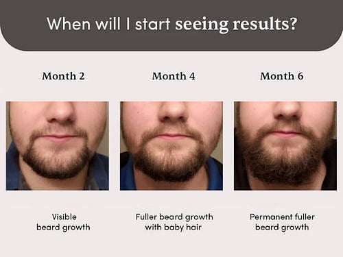 Man Matters Beardmax Growth Serum - Indyancart