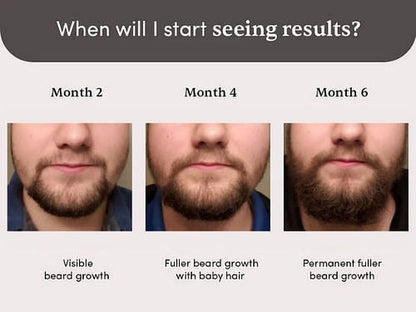 Man Matters Beardmax Growth Serum - Indyancart