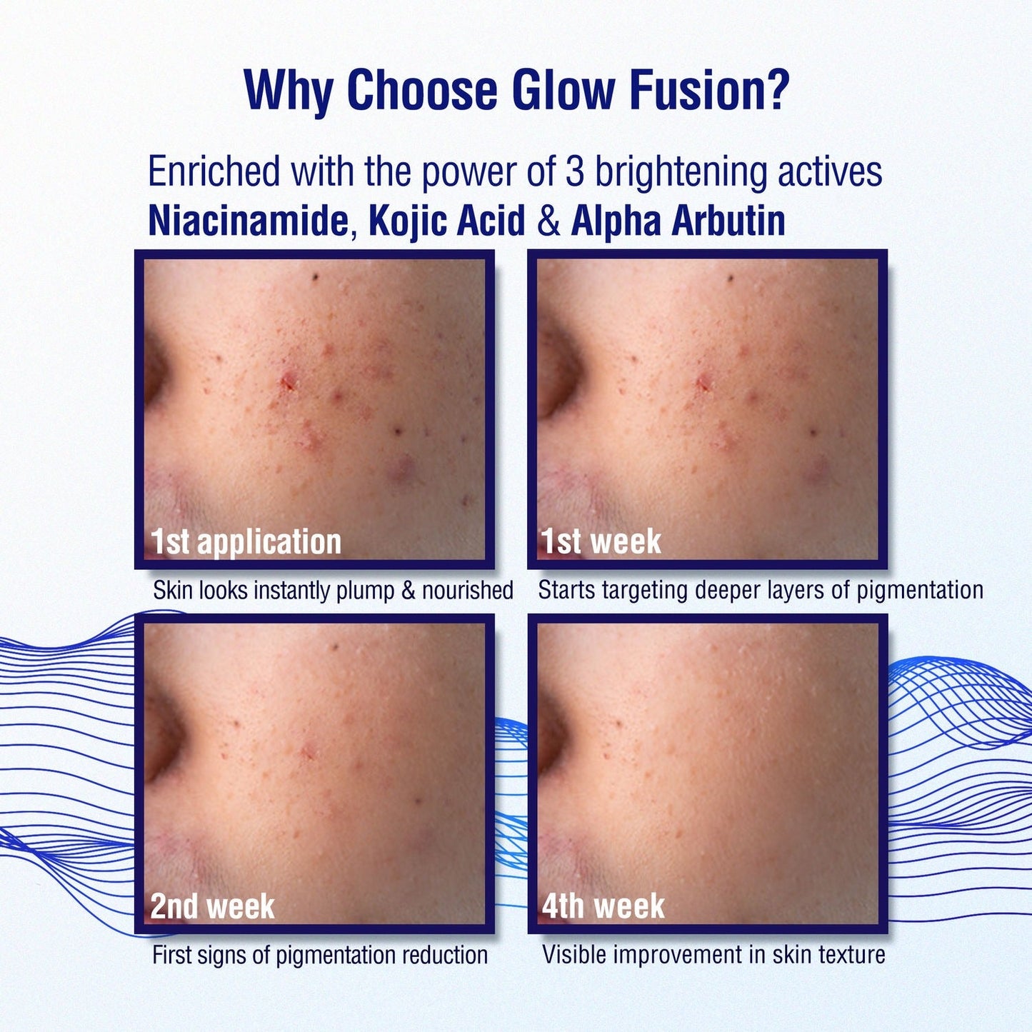 Dermdoc 2% Kojic Acid Night Cream - Indyancart