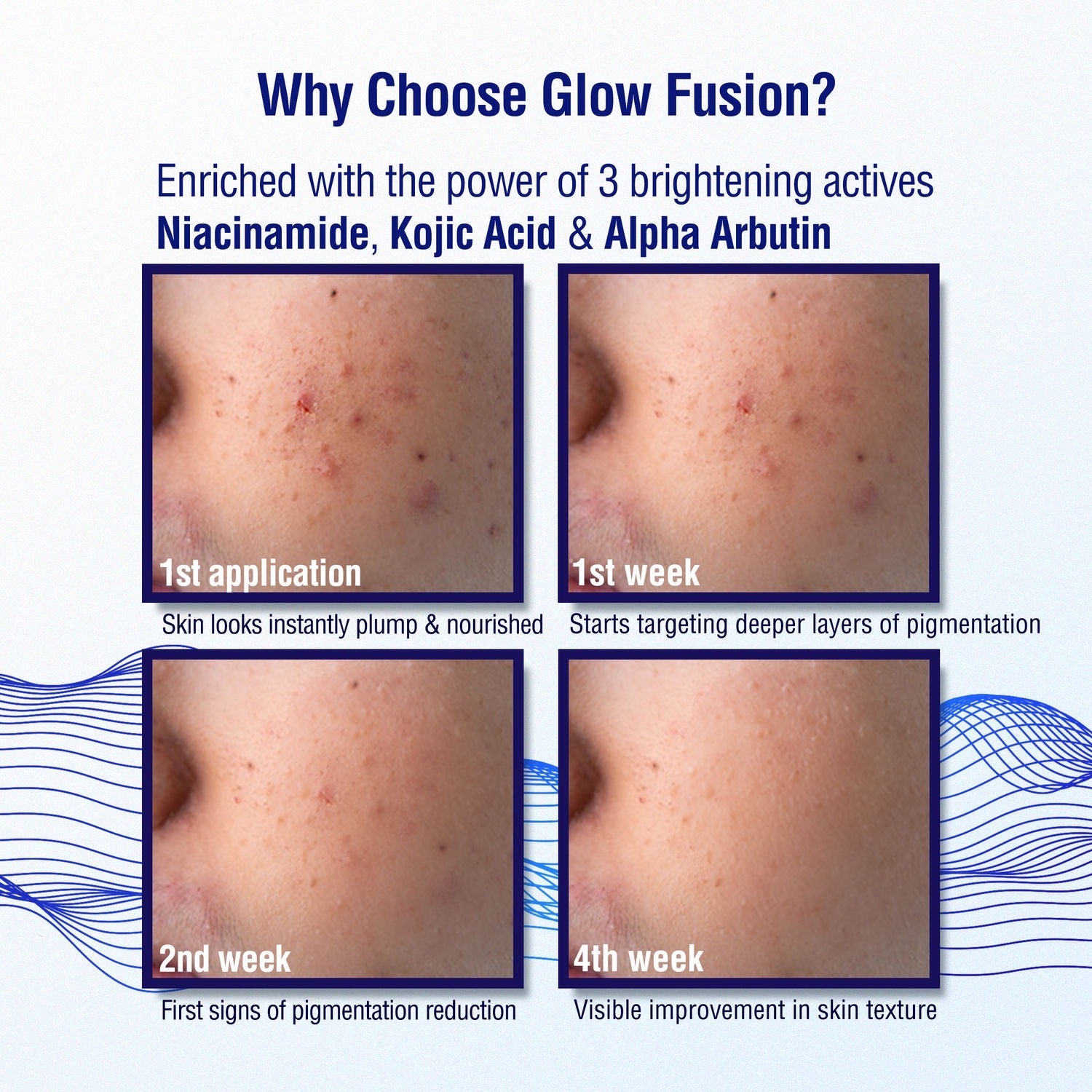 Dermdoc 2% Kojic Acid Night Cream - Indyancart