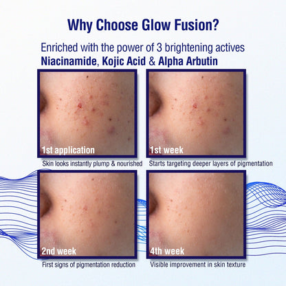 Dermdoc 2% Kojic Acid Night Cream - Indyancart