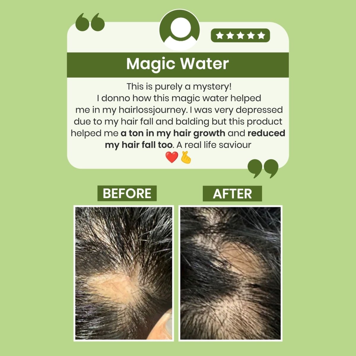Alps Goodness Rosemary Water for Hair Regrowth - Indyancart