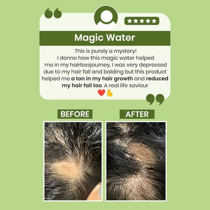 Alps Goodness Rosemary Water for Hair Regrowth - Indyancart