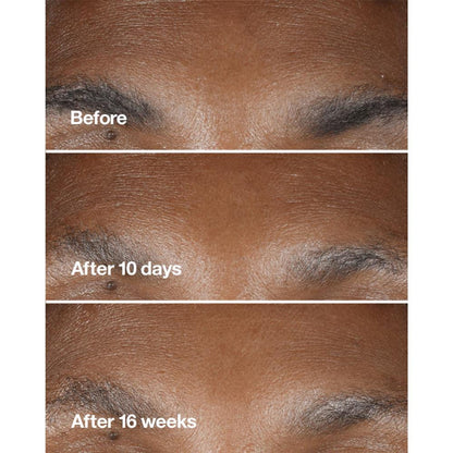 Clinique Smart Clinical Repair Wrinkle Correcting Serum