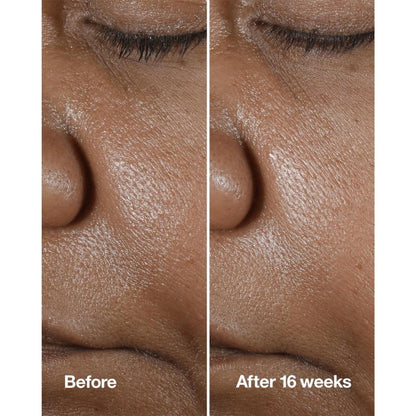 Clinique Smart Clinical Repair Wrinkle Correcting Serum