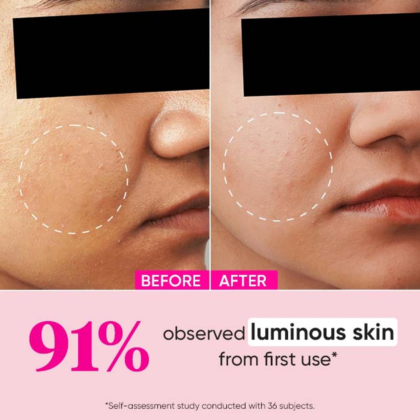Dot & Key 10% Glycolic Watermelon Super Glow Face Serum For Pigmentation