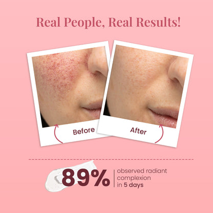 La Pink Ideal Bright Face Wash Boosts Radiance Improves Texture Reduce Pigmentation Dark Spots
