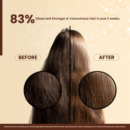 La Pink Lemon Ginger Anti Dandruff Shampoo Soothes Itchy Scalp And Strengthens Hair