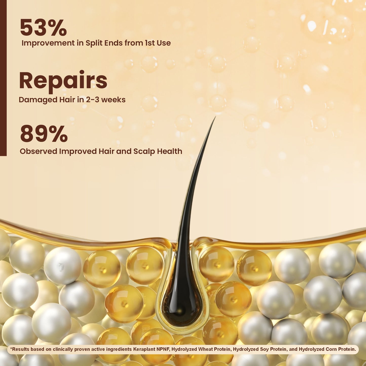 La Pink Lemon Ginger Anti Dandruff Shampoo Soothes Itchy Scalp And Strengthens Hair