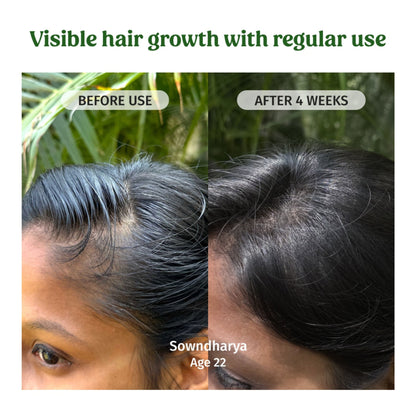Vilvah Hair Growth Oil To Reduce Hair Fall & Improve Scalp Health With Kalonji & Castor Oil