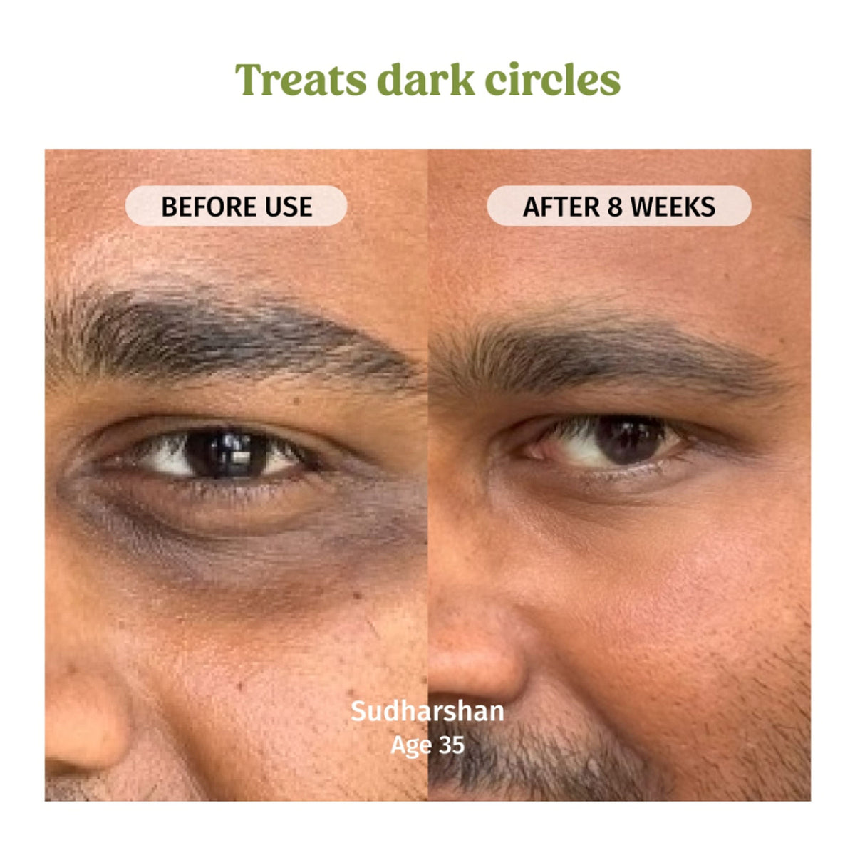 Vilvah Under Eye Cream For Puffiness & Dark Circles Control With Bamboo & Goji Berry