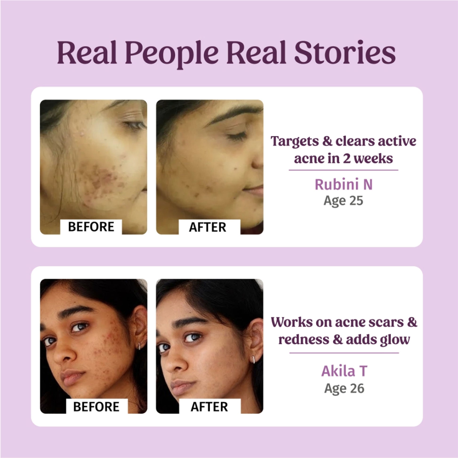 Vilvah Honey Fix Face Wash To Treat Acne, Control Oil & Balance Ph With Honey & Papaya Extract