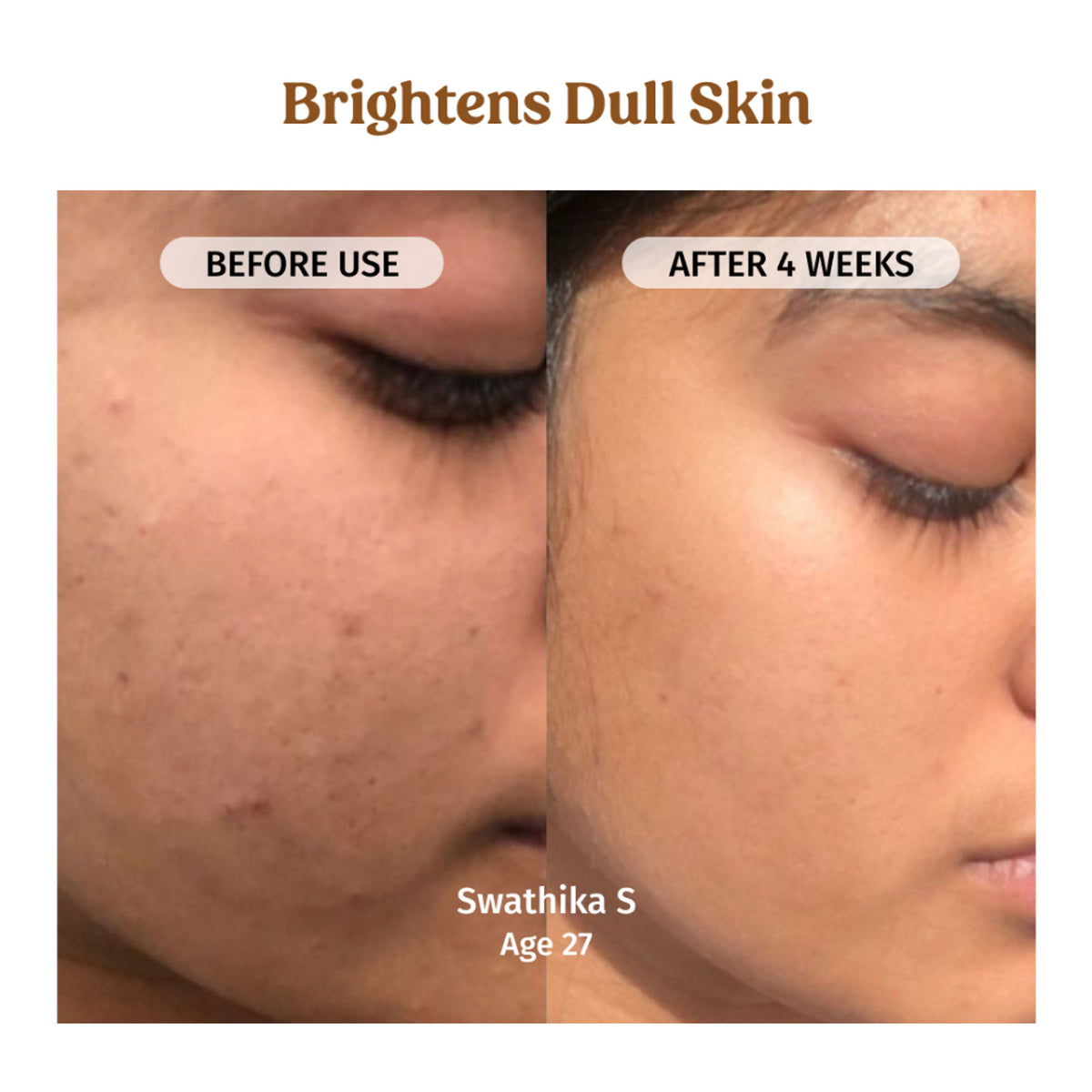 VILVAH Milk Drops Skin Brightening Serum With Rice Milk, Marine Algae Extract & Alpha-Arbutin