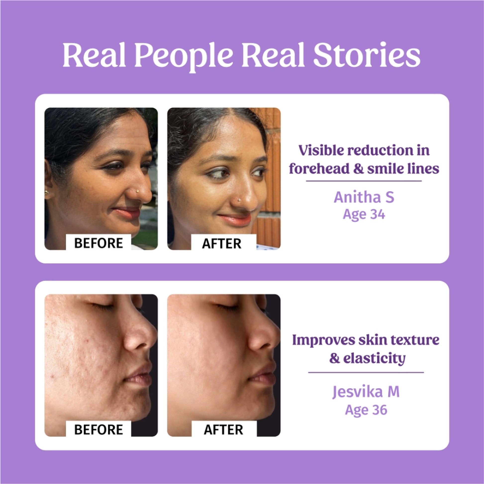VILVAH Better Ageing Overnight Serum with BluePea Flower Extract, Bakuchiol, Ceramides & Peptides
