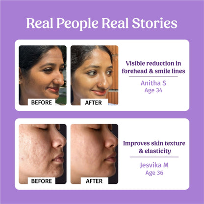 VILVAH Better Ageing Overnight Serum with BluePea Flower Extract, Bakuchiol, Ceramides & Peptides