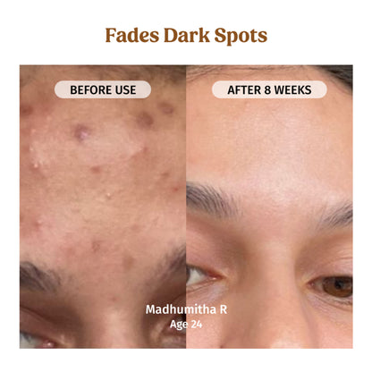Vilvah Milk Drops Brightening Serum For Hydrated Skin, Dark Spot Care & Hyperpigmentation