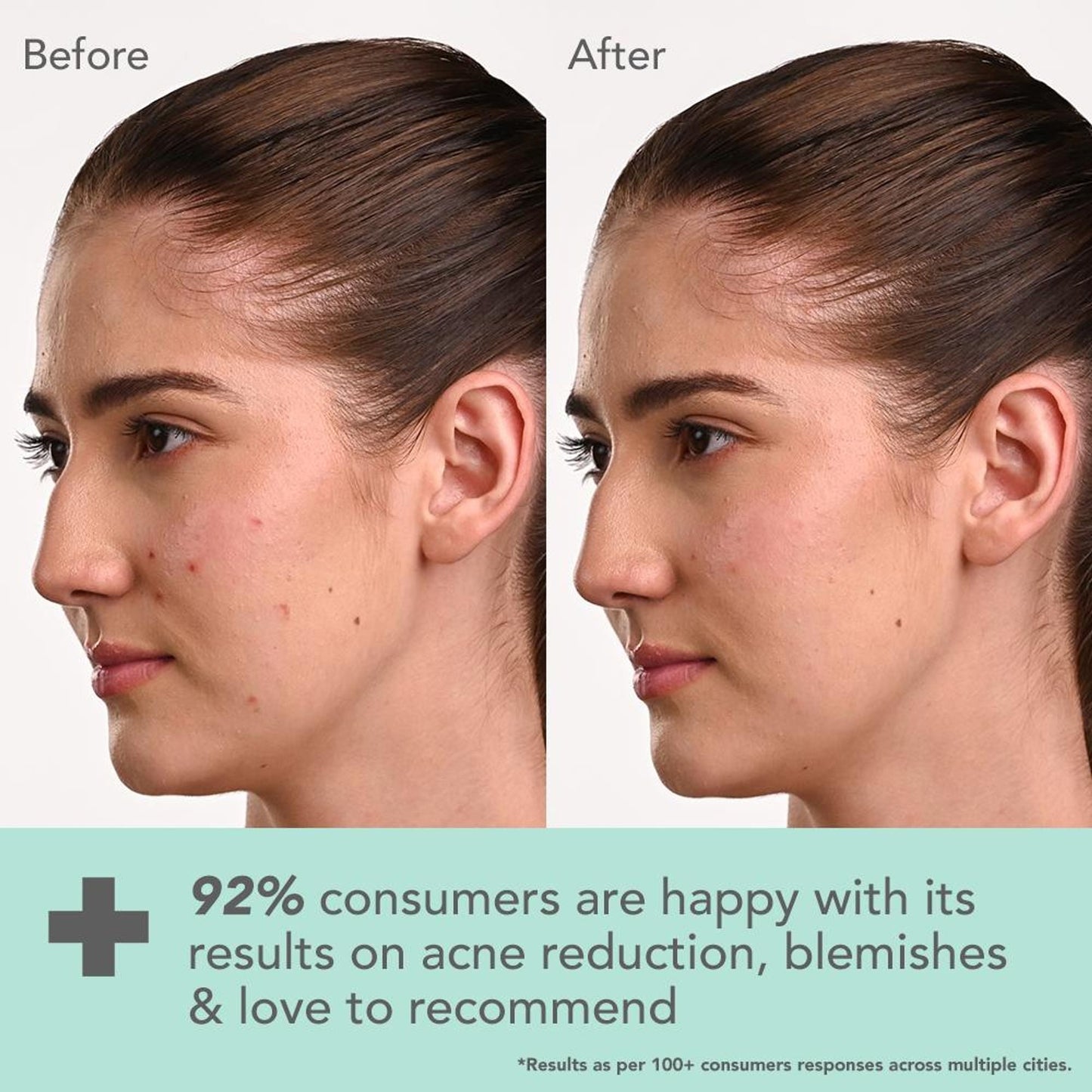 Lotus DermaBotanics Kojic Acid + Multi Berry Blemish-Free Face Wash, pH5.5, For Sensitive Skin additional image 4
