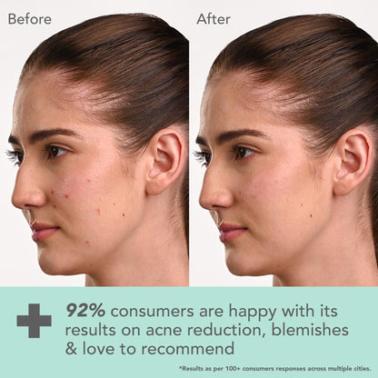 Lotus DermaBotanics Kojic Acid + Multi Berry Blemish-Free Face Wash, pH5.5, For Sensitive Skin additional image 4