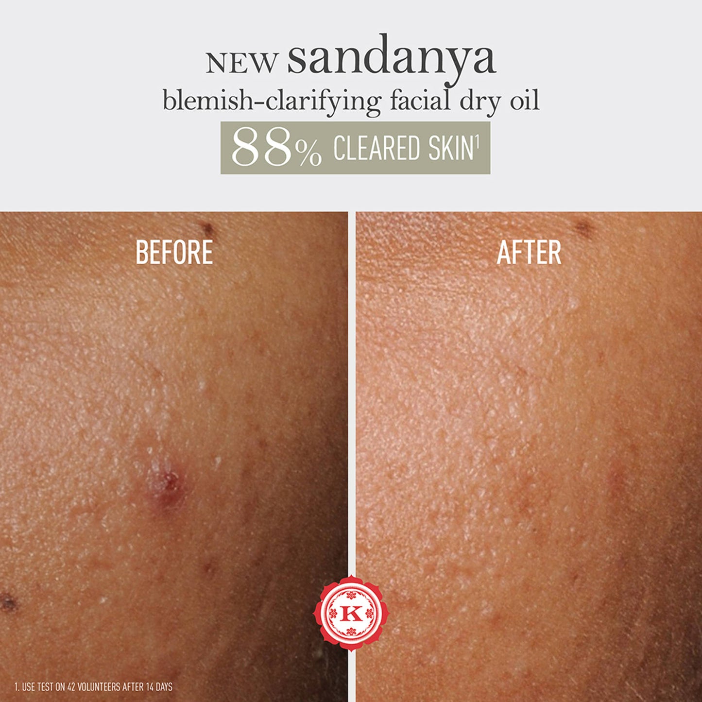 Kama Ayurveda Sandanya Blemish Clarifying Dry Oil