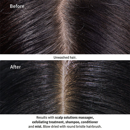 Aveda Scalp Solutions Balancing Conditioner - Boosts Scalp Hydration by 92%